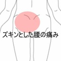 座ると増す左腰部のズキンとした痛み 　登別室蘭すのさき鍼灸整骨院　症例報告