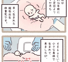 『486gの超低出生体重児として生まれた娘。容姿にコンプレックスを抱えた彼女に、卒業間近の教室で起きた小さな奇跡【ヤンチャな騎士】』| #427