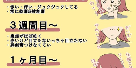 こんな女の ほくろ除去 Powered By ライブドアブログ