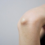 【閲覧注意】『粉瘤』の中身、全部出てくる…