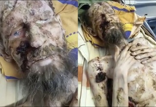 【閲覧注意】ヒグマに襲われ一ヶ月間生き埋めにされた男性が救出される