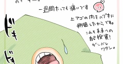 インプラント手術🦷