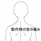 『むち打ち後の左頸部痛と動作制限　登別室蘭すのさき鍼灸整骨院　症例報告』の画像