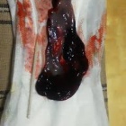 超閲覧注意 生理中のワイ とんでもない血の塊が出て驚愕 エッッッ