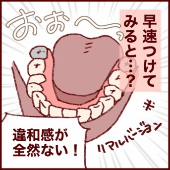 大人の歯科矯正卒業か…？とっくに入れ歯が出来ている話