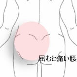 『デスクワーカーの屈曲時に痛む急性腰痛　登別室蘭すのさき鍼灸整骨院　症例報告』の画像