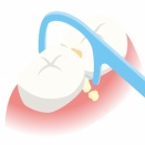 AIを活用した検査や診断法