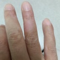 ヤケドのケガはまだ完全に皮膚が再生しておらず薬は塗らなくてはいけない状態ですが包帯を巻かなくてもよくなりました！お盆明けからお弁当作り再開できたらと思います。