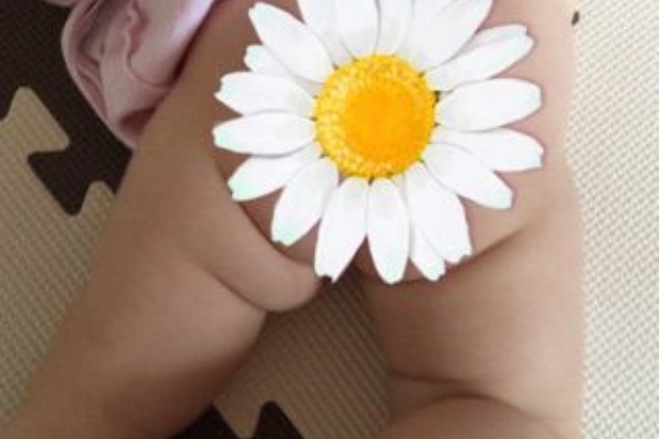 先天性股関節脱臼治療の日記