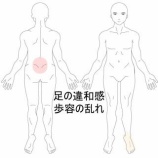 『脚に力が入らず歩くと左脚がパタンパタンする症状　 登別室蘭すのさき鍼灸整骨院　症例報告』の画像