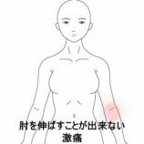 『左肘が伸ばせず重だるいテニス肘様症状　登別室蘭すのさき鍼灸整骨院　症例報告』の画像