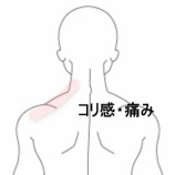 『左肩上部のコリ感と顎関節の緊張 　登別室蘭すのさき鍼灸整骨院　症例報告』の画像