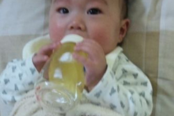 まんまるあたま 変形性斜頭症