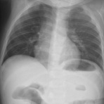 こどもの病気・おとなの病気