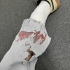 左足を負傷——人生で一番大きなケガをした話
