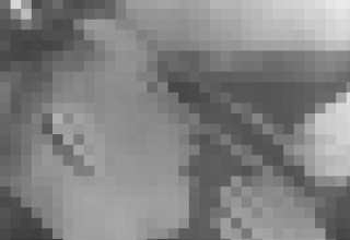 【閲覧注意】精神外科（ロボトミー）とかいう実際にあったマジキチ医学