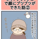 ホットフラッシュで顔にブツブツができた話②