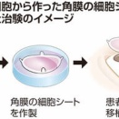 【iPS角膜】の治験開始、2028年にも承認を国に申請　大阪大発新興企業「レイメイ」