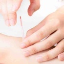 鍼を刺したまま「時間を置く」のはなぜ？