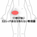 『梨状筋の緊張でストレッチが困難な左臀部痛　登別室蘭すのさき鍼灸整骨院　症例報告』の画像