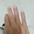 ヤケドのケガはまだ完全に皮膚が再生しておらず薬は塗らなくてはいけない状態ですが包帯を巻かなくてもよくなりました！お盆明けからお弁当作り再開できたらと思います。