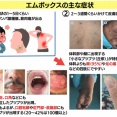 【悲報】日本、完全終了。コロナなんて比じゃないほどヤバい“サル痘”がついに日本上陸
