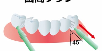 【口臭対策】歯石を取って、夜だけでも歯間ブラシを使ったら口臭が劇的に改善した。