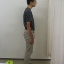 Ｙさんの姿勢矯正