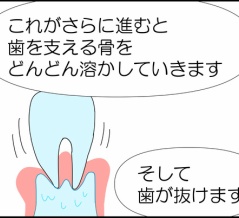 歯周病菌と戦う①