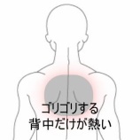 『デスクワークで首から背中がゴリゴリする違和感 　登別室蘭すのさき鍼灸整骨院　症例報告』の画像