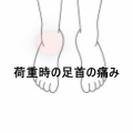 左踵痛から右足首痛へ移行した立ち仕事後の症状 　登別室蘭すのさき鍼灸整骨院　症例報告　