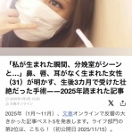 私、重度の口唇口蓋裂です。