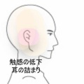右顔面の感覚異常と耳の詰まり感の改善例 　登別室蘭すのさき鍼灸整骨院　症例報告