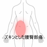 『起床時から動けなくなった左腰臀部のズキンとした痛み　登別室蘭すのさき鍼灸整骨院　症例報告　』の画像