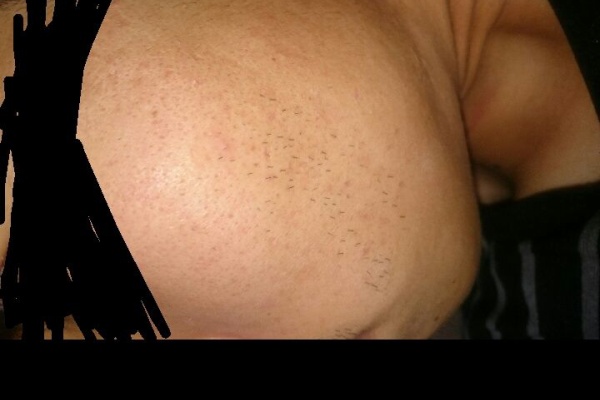 脱毛まとめ 除毛クリーム