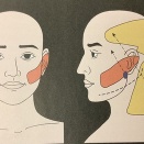 筋肉、骨格系の痛み　その6