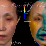 ～Dr.Fumiの美容Blog～