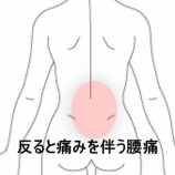 『後屈時の腰痛で競技に支障が出た陸上選手 　登別室蘭すのさき鍼灸整骨院　症例報告』の画像