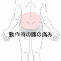 柔道の試合後に起きた腰の張りと回旋時痛 　登別室蘭すのさき鍼灸整骨院　症例報告