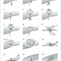 How To Sew A Button