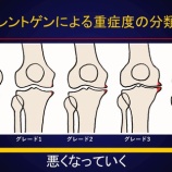 『変形性膝関節症とスポーツ』の画像