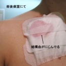 裏返しに履いた靴下