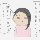 皮膚科で老人性イボ(脂漏性角化症)をとってもらう・後編