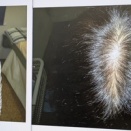 薄毛問題、半年後