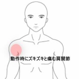 『重量物作業後の右肩前面部痛とズボン動作困難 　登別室蘭すのさき鍼灸整骨院　症例報告』の画像