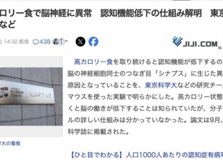 【研究】デブ「高カロリー食うんめえ！濃けりゃ濃いほどうめえ！」→デブは脳神経に異常が発生し認知機能が低下していると判明