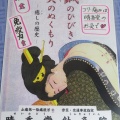 8月９日は「はりきゅう」の日。はり・お灸は最高！