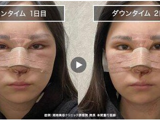 【悲報】整形依存さん、恐ろしいと話題にｗｗｗｗｗｗｗｗｗｗ