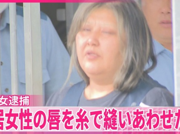 日本で同居人の唇を縫い付けた女が逮捕される！　海外の反応。