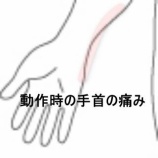 『左手首小指側の回内・回外時の鈍痛』の画像